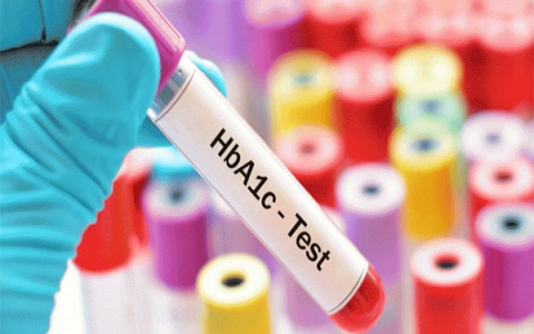 Ý nghĩa của xét nghiệm máu HbA1c bạn nên biết