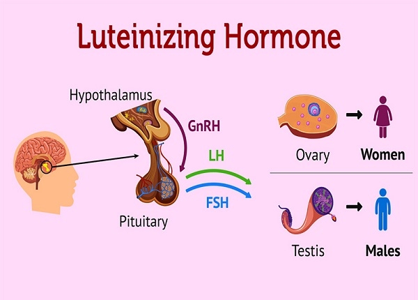 Những bệnh lý liên quan đến nồng độ LH