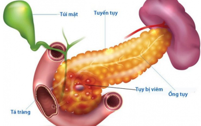 8 loại thực phẩm tốt cho người bị “viêm tuyến tụy”