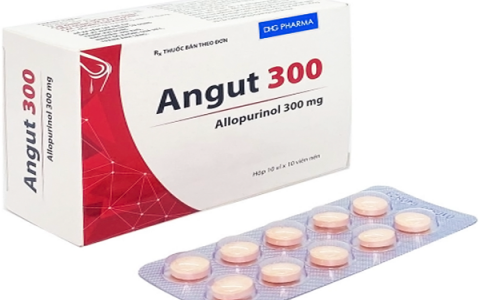  Angut 300 điều trị gout mạn và lưu ý khi sử dụng