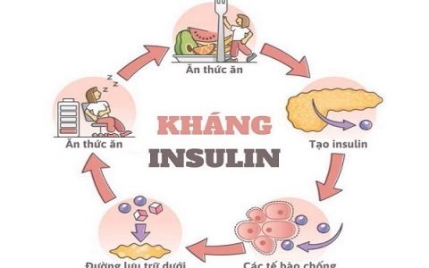 BẠN BIẾT GÌ VỀ KHÁNG INSULIN VÀ ĐƯỢC ĐIỀU TRỊ NHƯ THẾ NÀO?