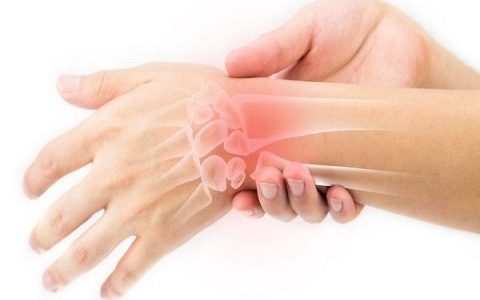 Cách giảm bớt cơn đau từ hội chứng ống cổ tay