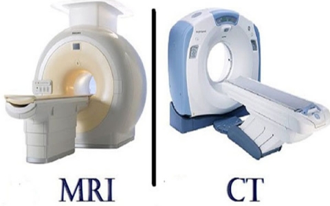 Sự khác nhau giữa chụp MRI và chụp CT