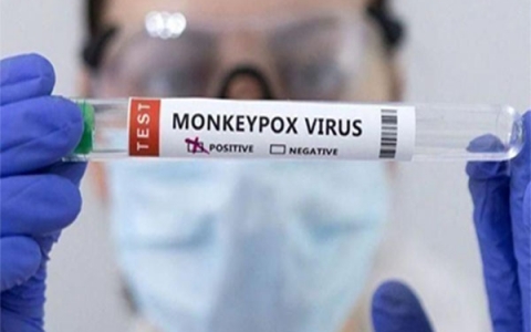 Bệnh đậu mùa khỉ là gì-một số thông tin cần phải biết