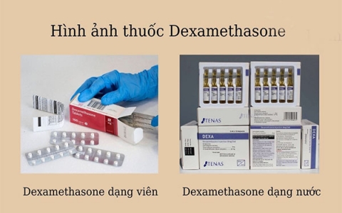Thuốc Dexamethasone là gì và những lưu ý khi dùng