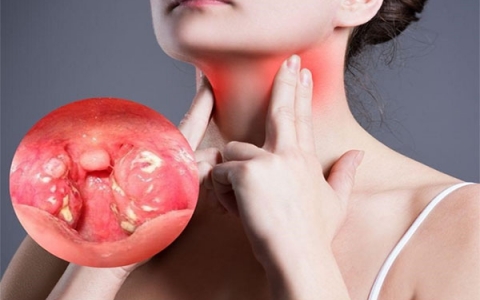 Những phương pháp điều trị đau họng bạn cần biết
