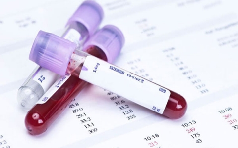 Hiểu rõ hơn về xét nghiệm công thức máu toàn phần