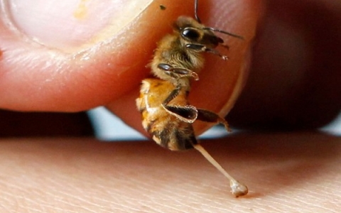 Hướng dẫn cách xử trí sau khi bị ong đốt