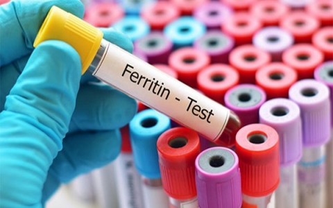 Xét nghiệm ferritin: Phát hiện sự thiếu hụt sắt và bất thường dinh dưỡng
