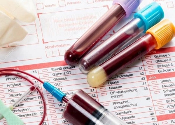 Xét nghiệm sinh hóa máu giúp chẩn đoán bệnh lý